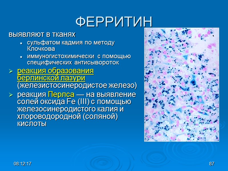 08:12:02 87 ФЕРРИТИН выявляют в тканях  сульфатом кадмия по методу Клочкова иммуногистохимически с